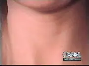 Groland nue - Consultation docteur Pi : grippe