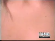 Groland nue - Consultation docteur Pi : grippe