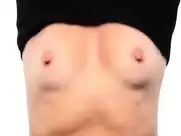 Test Yourself Save Your Life: mammogram commercial