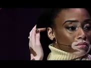 Winnie Harlow nude in Instagram famous sex scenes